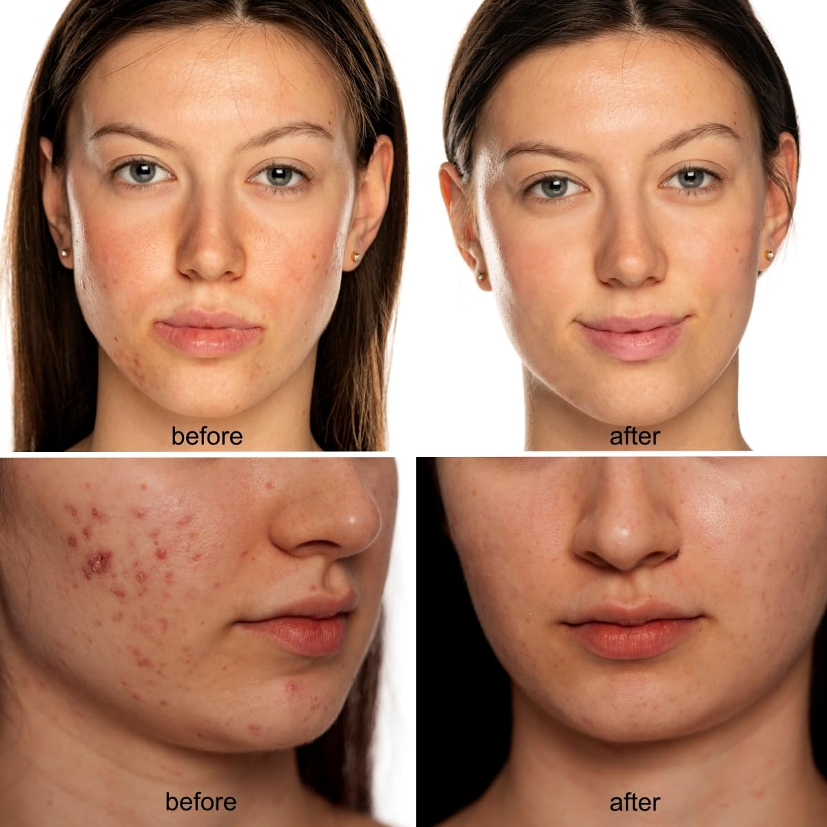 Beauty LED mask – Red Light & Infrared Light Therapy Face Mask for Wrinkles – Blue Light for Acne – Multi-wavelength for Skincare – Rechargeable for Home Use and Travel Model: KFB265