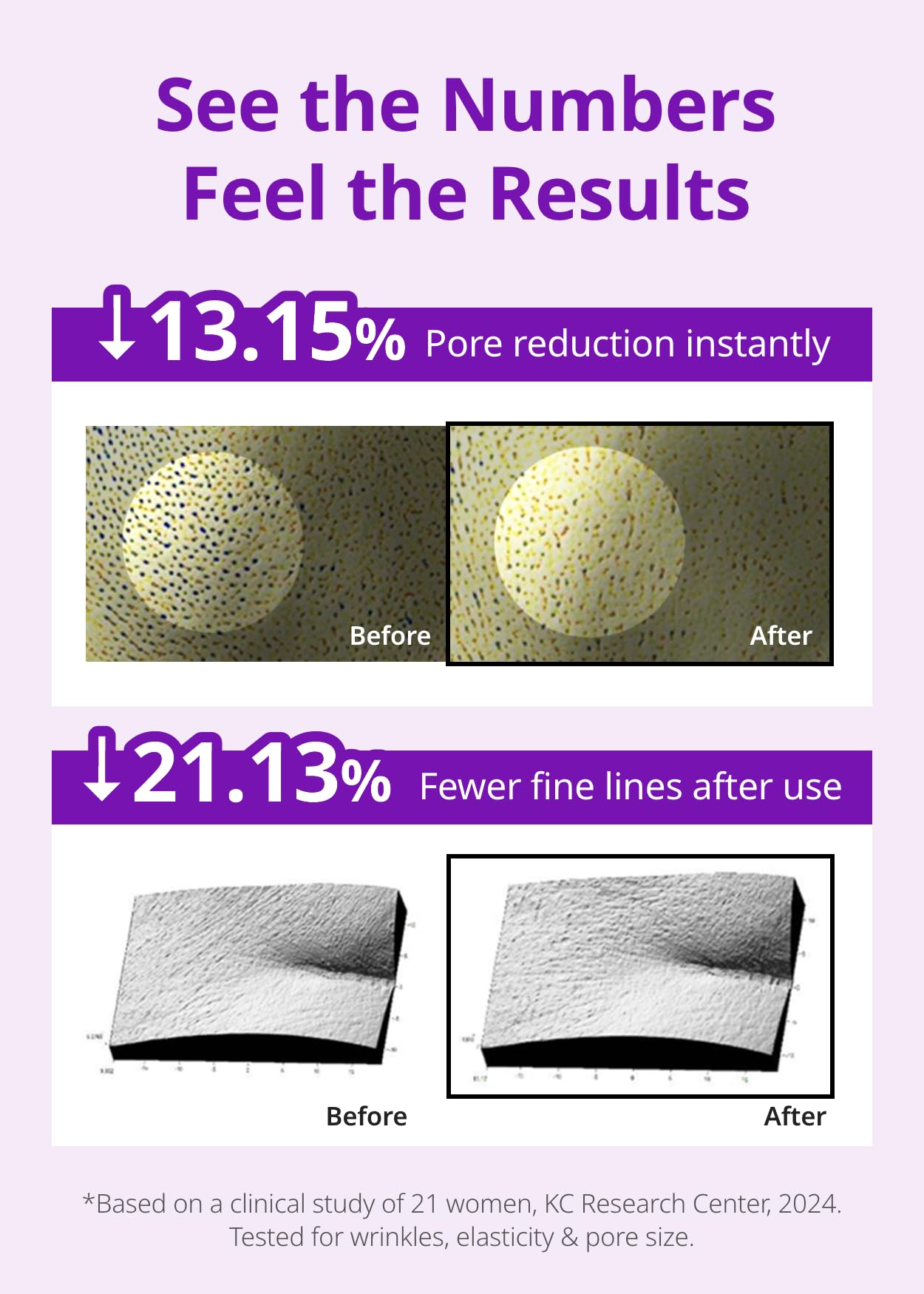 SNP 10,000ppm Deep Collagen + PDRN + Retinol Hydrogel Mask | 8 Layer 125Da Collagen Face Mask | Overnight Facial Mask | Patent Skin Hydration | Hydrating Facial Mask | Face Mask Skin Care | 4 Sheets