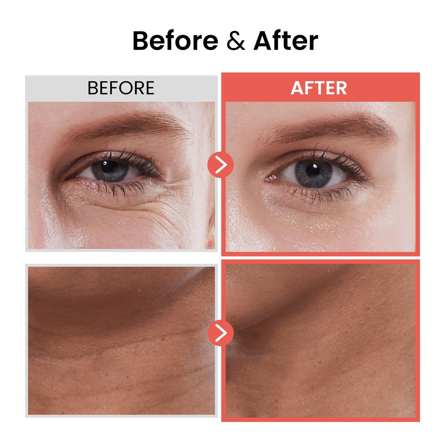 the SKIN HOUSE Wrinkle Supreme Serum 0.67 fl. oz. Trial-Size, Korean Red Ginseng, Mushrooms | Firming, Lifting, Fine Lines | Korean Skin Care, K-beauty, 20ml