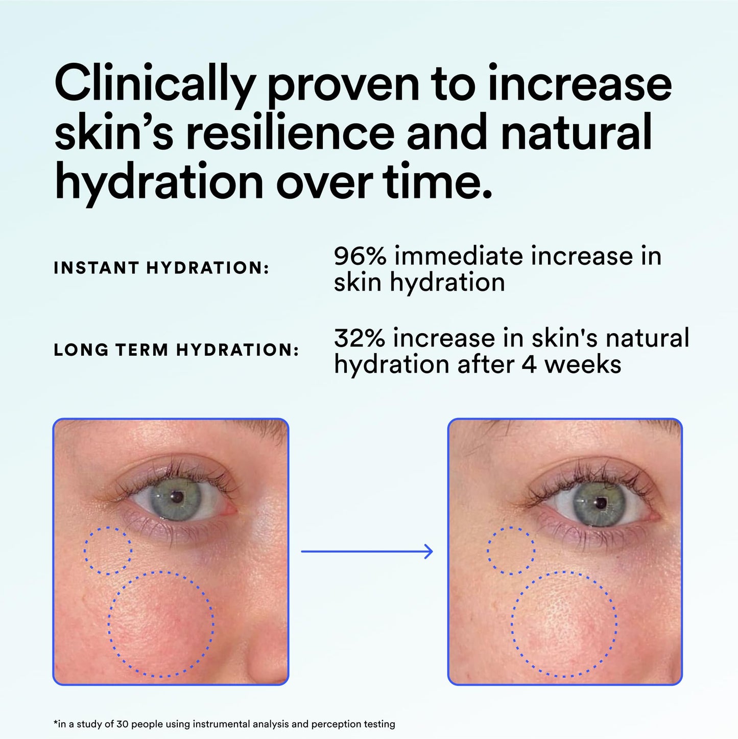 Experiment Super Saturated Ultra Hydrating Barrier Serum – 30% Glycerin, Polyglutamic Acid + Prickly Pear for Intensive Moisture, Plump + Dewy Skin, 1.35 FL OZ – Vegan for All Skin Types