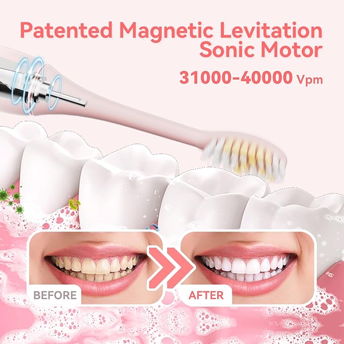 KIWIBIRD Sonic Electric Toothbrush – K1 MINI Slim & Lightweight (85g), 90-Day Battery, with Travel Case & Leather Pouch, IPX7 Waterproof, for Adults & Teens, Ideal for Travel & Sensitive Teeth (Pink)