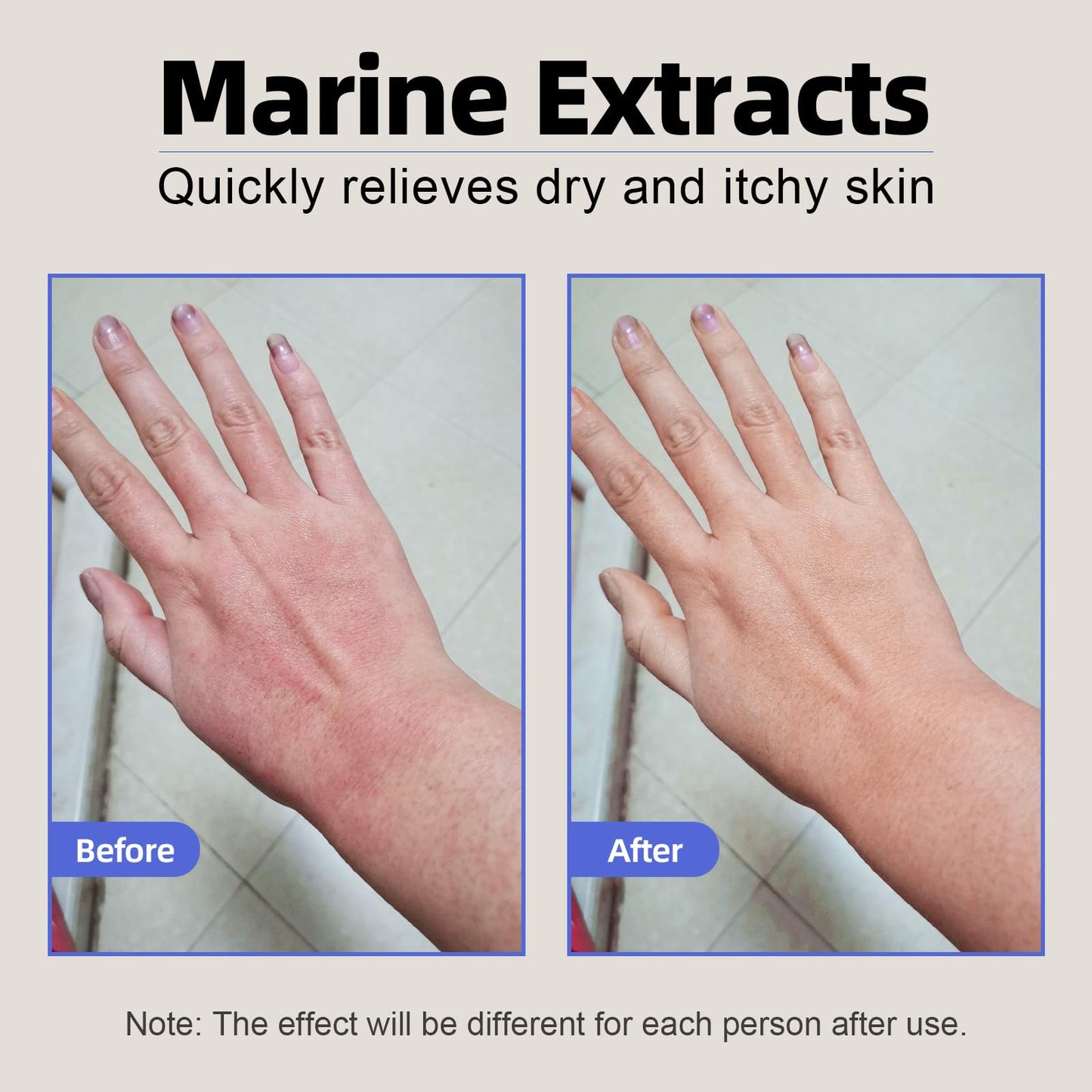 Natural Organic Eczema Soothing Cream Made With Sea Moss Aloe Vera, Oats! Sensitive Skin Dry Skin Hydrating Comfort Moisture Fragrance Free Skin care