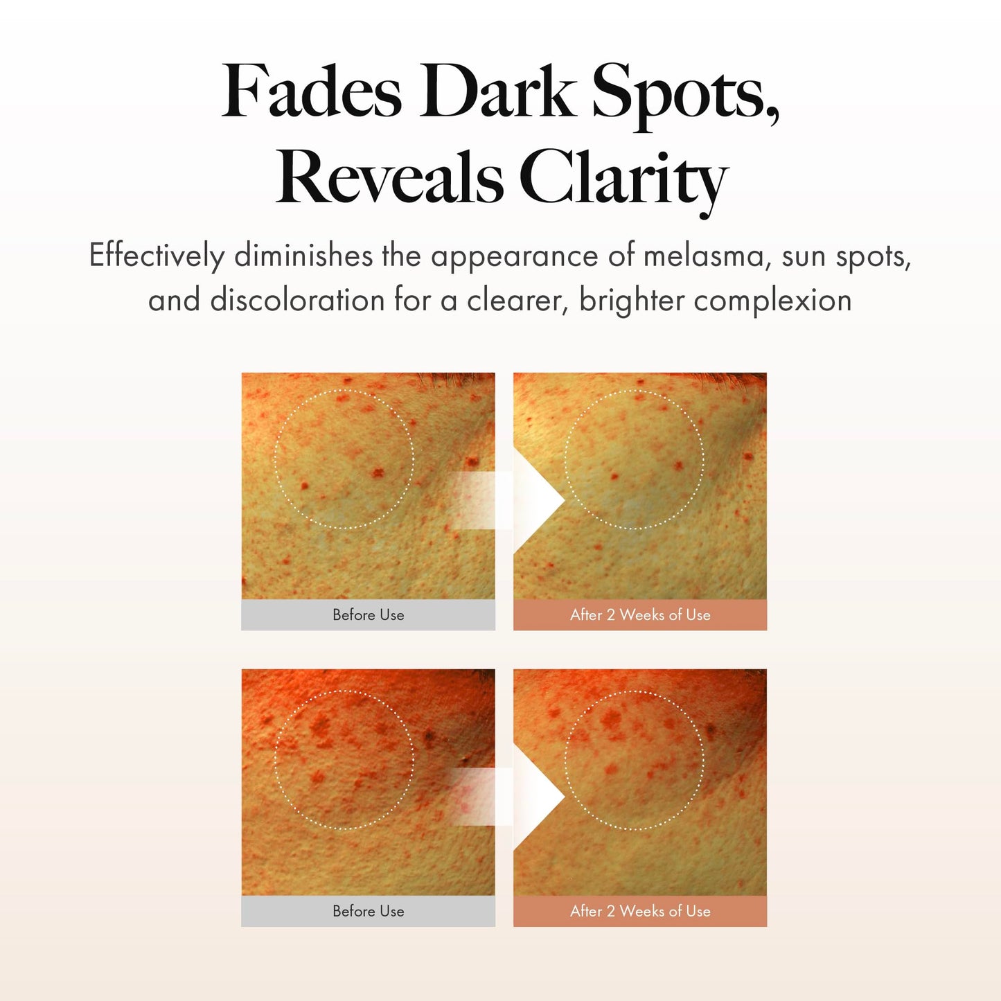 MASTINA White Mastic Wrinkle Bounce Multi Balm Stick (0.35oz), Korean Anti-Aging Face Balm with Mastic & Vegan Collagen for Fine Lines, Neck Wrinkles & Radiant Glow, On-the-Go Hydration