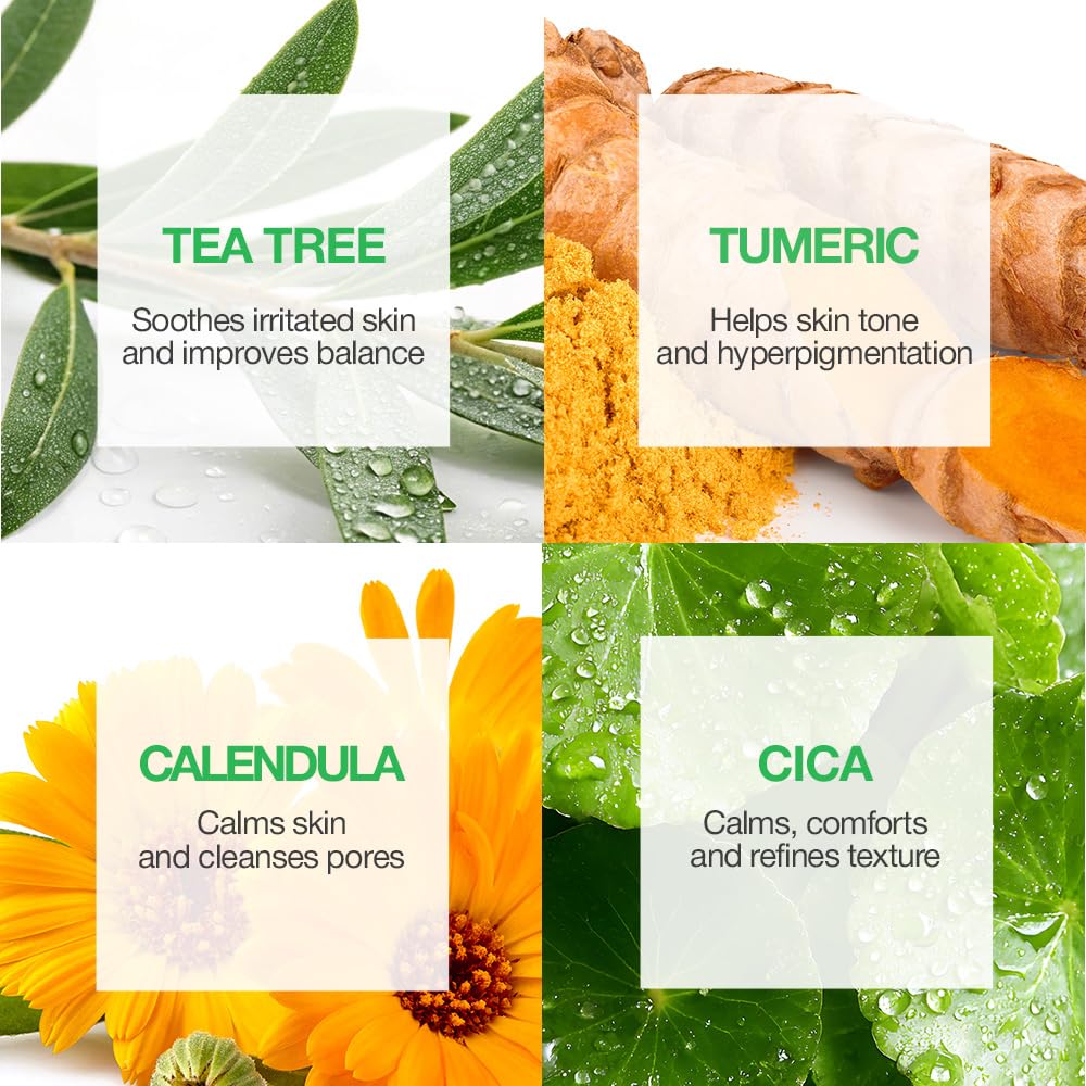 15 Min Rescue Me Kit by Naisture – Korean Spa and Skincare Kit for Women with Cica, Turmeric, and Tea Tree Sheet Masks, Eye Mask, Calendula Cucumber Mask, and Charcoal Mint Mud Mask for Redness Repair