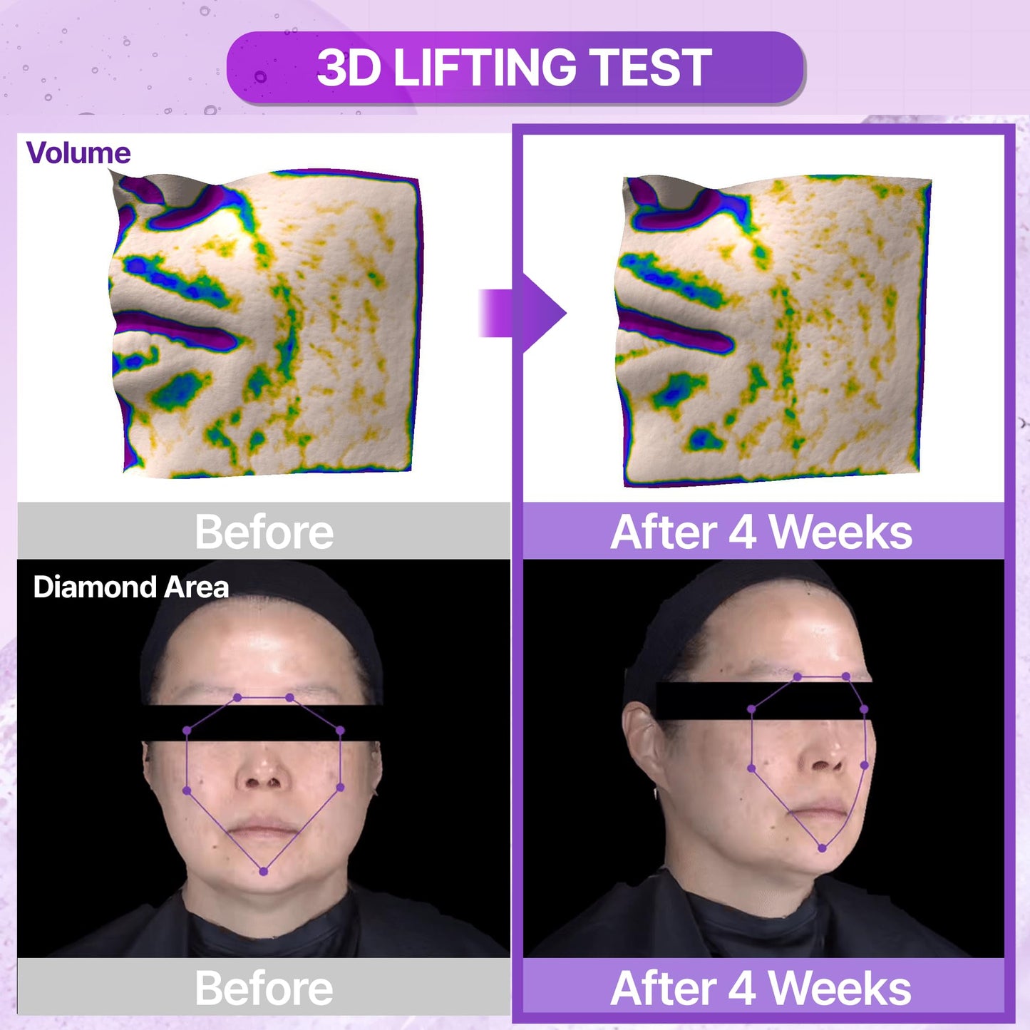 BIOHEAL BOH Probioderm™ 3D Lifting Ampoule 1.01 fl oz (30 ml) | Advanced Elasticity Serum for Sculpted, Firm Skin | Powerful 3D Lifting Formula with Probiotics & Peptides for Daily Skincare