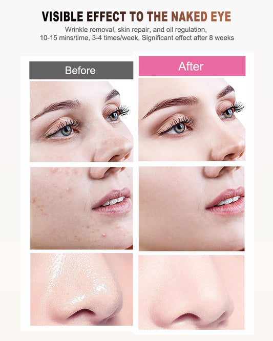 BETNEP Red Light Therapy for Face, LED Face Mask Light Therapy,Near-Infrared 850 Red Light Therapy Mask(NIR),Portable,Rechargeable and Remote