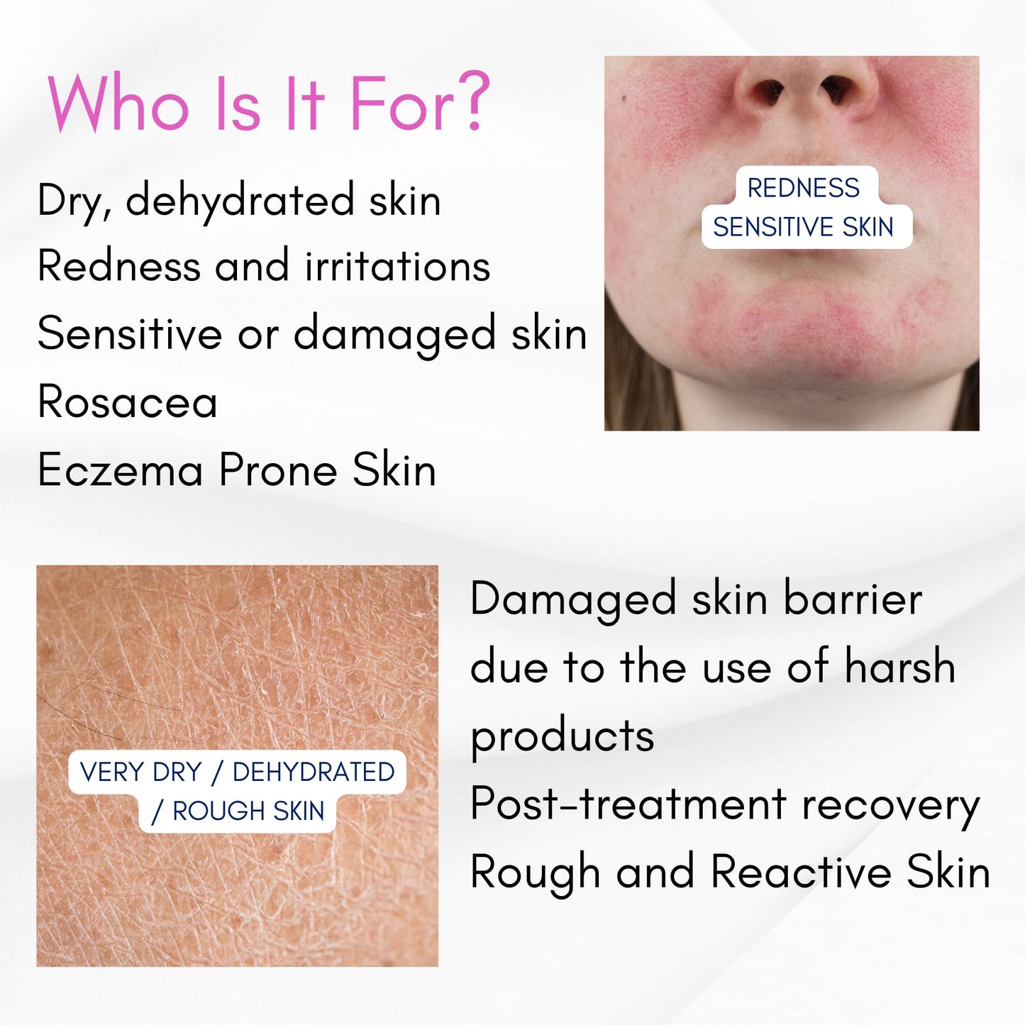 Skin Barrier Repair Serum – Restores and Supports the Skin Barrier, Strengthens & Soothes Sensitive Skin | Ceramides + EGF (Oligopeptide-1)+ Oat Extract + Probiotic Complex | Fragrance-Free (1 fl oz)