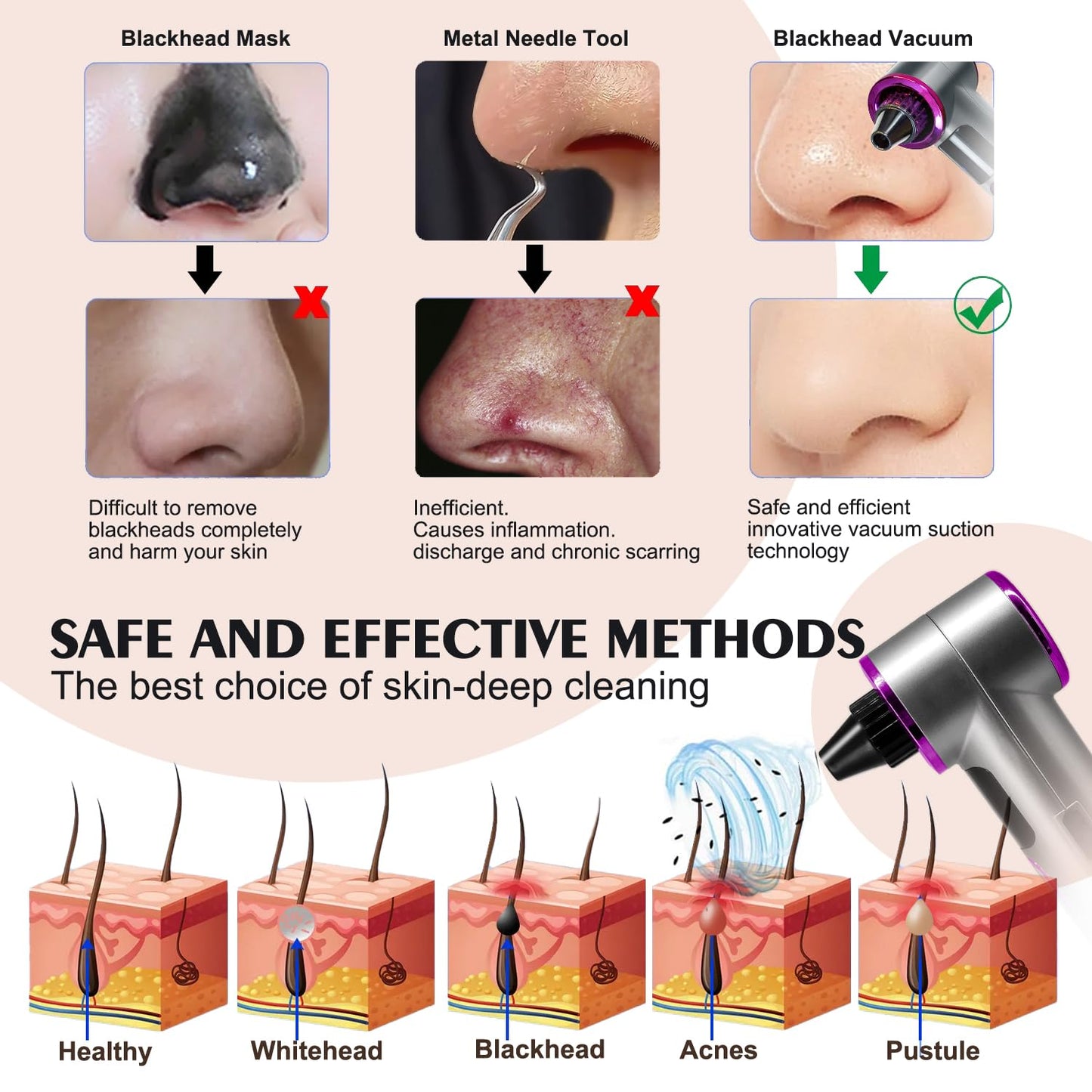 Blackhead Remover Vacuum with Heating, Blackhead Extractor 3 Adjustable Suction Levels 9 Modes, Pore Vacuum Blackhead Suction Remover, Comedone Extractor Kit for Deep Pore Cleaning (Purple)