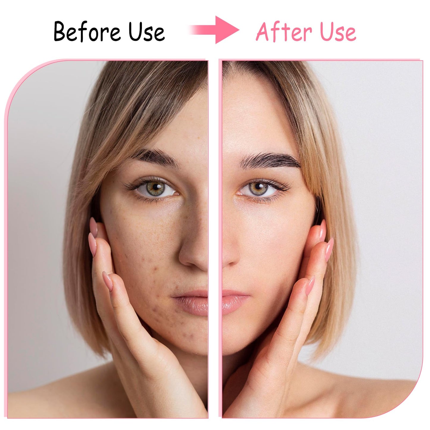 BOHUIZ 2Pcs Silicone Face Brush Manual Face Scrub Brush, Soft Facial Cleansing Brush Waterproof Exfoliating Face Brush Skin Friendly Face Cleaner Brush for Blackheads Makeup Residues Removal