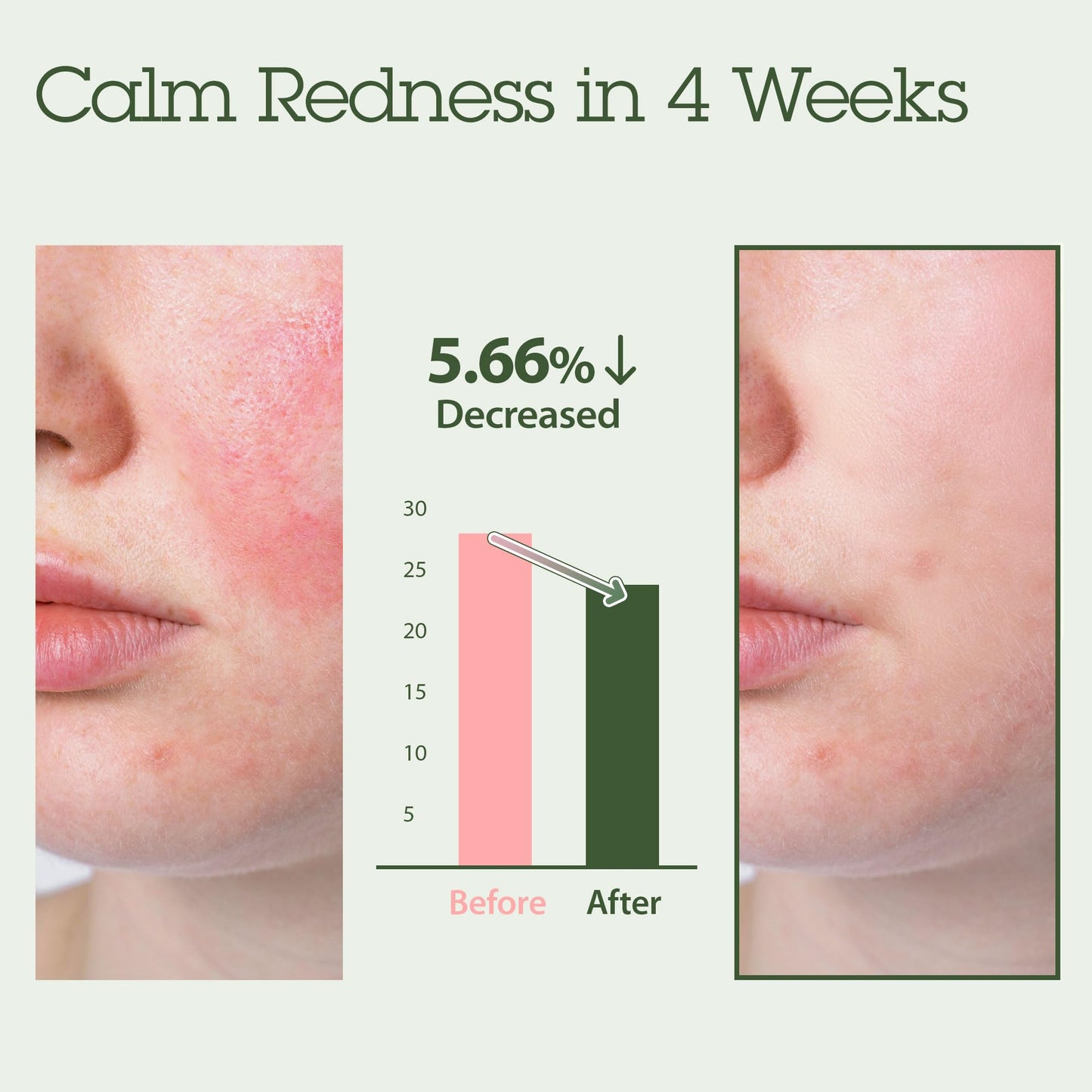 Blithe Korean Skin Care Products 6 Leaves Clear Essence for Rosacea & Redness Relief, BHA Toner Cooling Moisturizer for Face, Blackhead Treatment, Evening Primrose Wintergreen Green Tea 1.83 Oz