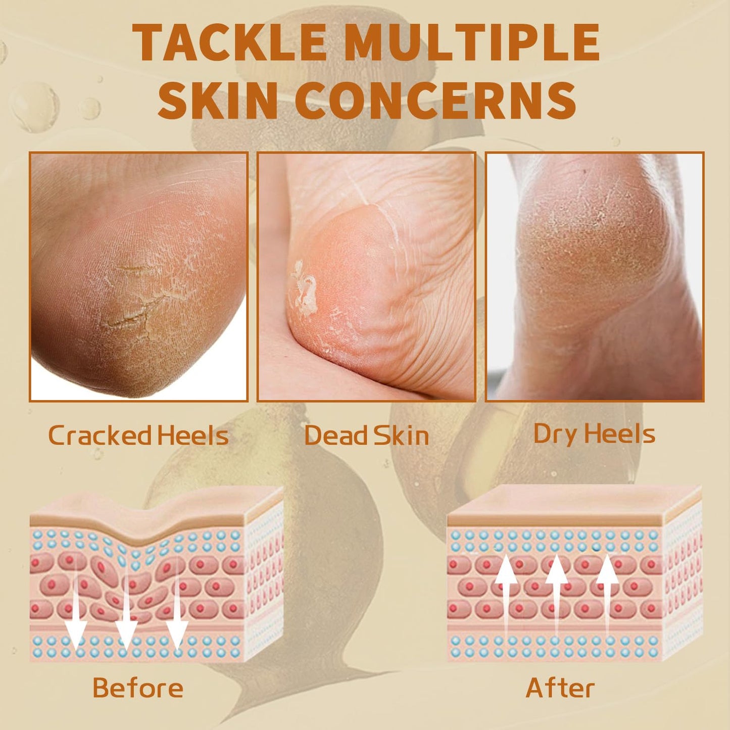 Danliss Heel Moisturizing Balm Stick Cracked Foot Nourishing Repair for Rough Dry Chapped Feet Hands Heels Nails Elbows with Shea Butter & Olive Vitamin E Natural Mild Moisturizer 1.41Oz (Shea Scent)