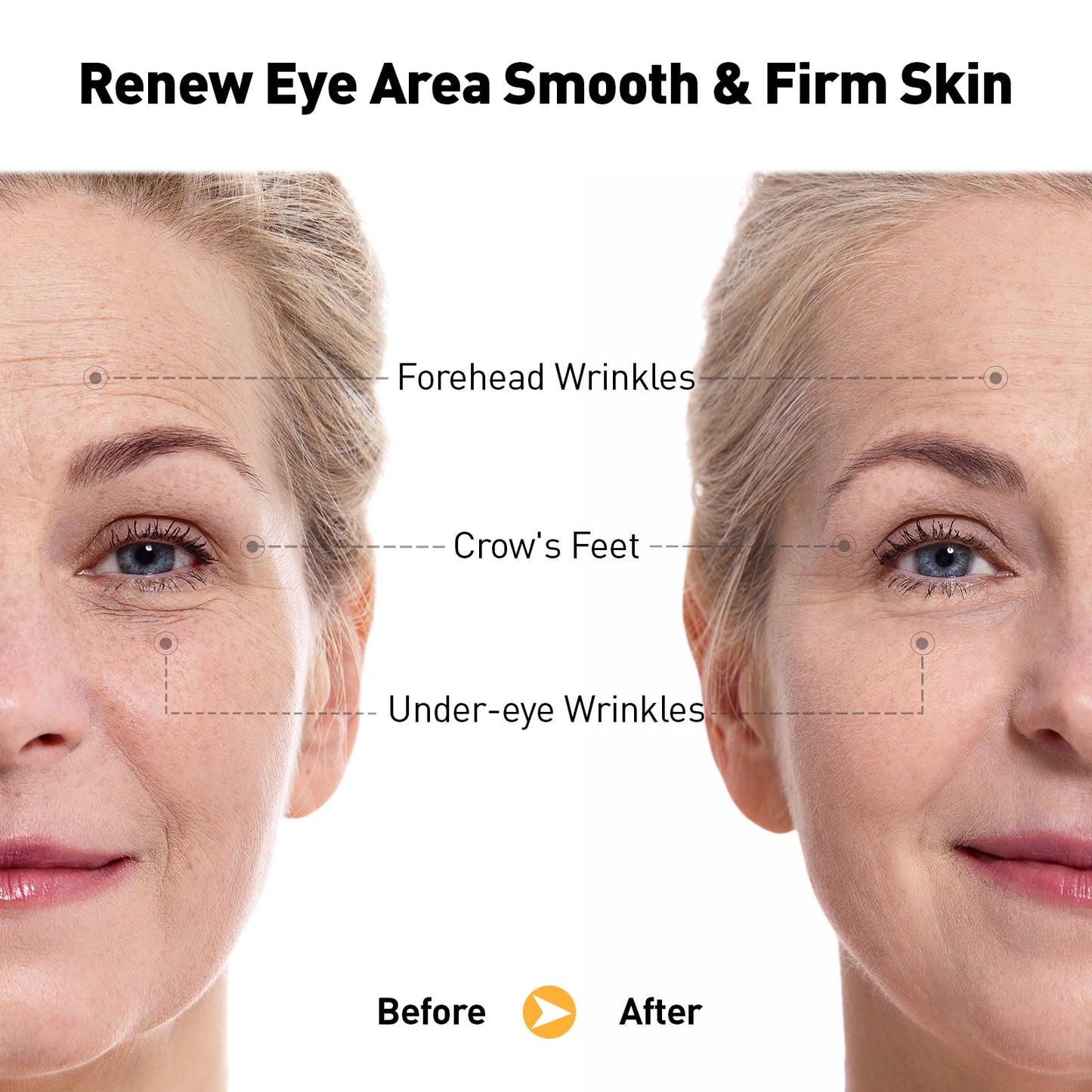 Eye Cream for Anti-Aging & Wrinkles – Firming, Hydrating & Repairing Eye Serum with Retinol, Niacinamide, Hyaluronic Acid, Vitamin E & Bifida Ferment Lysate, 0.7 Fl Oz (Pack of 1)