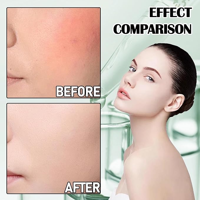 8Pcs Organic Aloe Vera Gel for After Sun Skin Care,Natural Moisturizing Aloe Vera Gel for Face & Body,Easy to Portable Face Moisturizer,Travel Size Pure Vera Aloe Gel for all Skin Types E