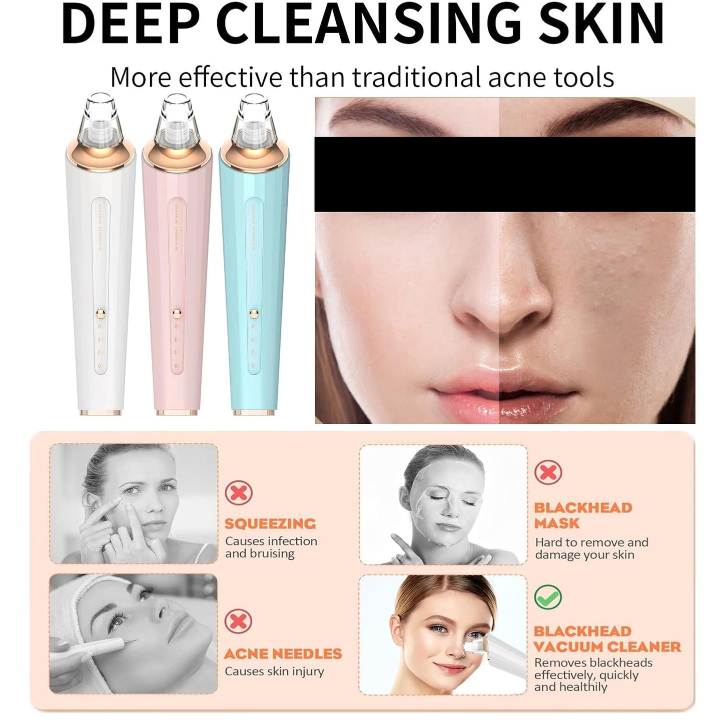 Blackhead Remover Pore Vacuum, Upgraded USB Rechargeable Facial Pore Cleaner Blackhead Removal Kit with 3 Suction Power,5 Probes Black Head Extractions Tool for Women & Men