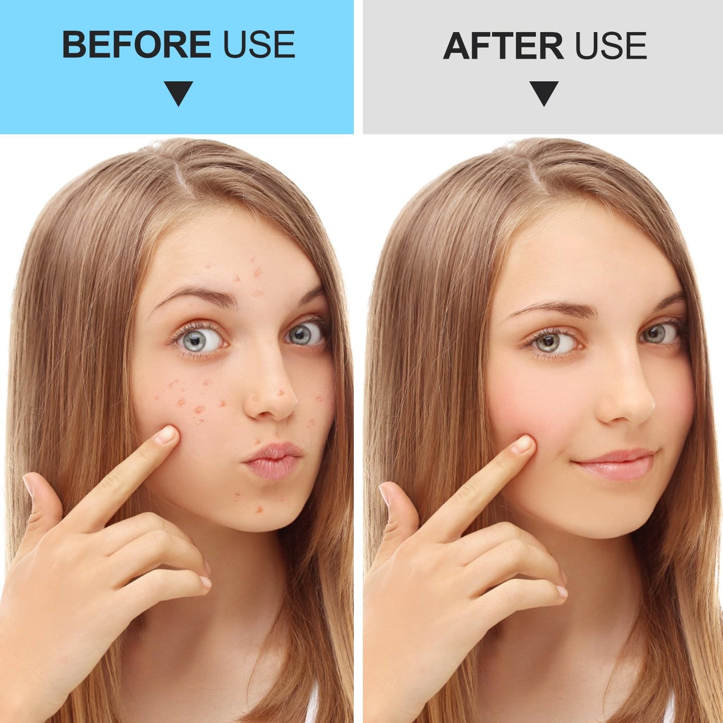 Blackhead Remover Tools, Face Scraper for Deep Cleaning, Pimple Popper Tool kit, Skin Scrubber Face Spatula, Skin Care Tool for Men and Women (Rose red)