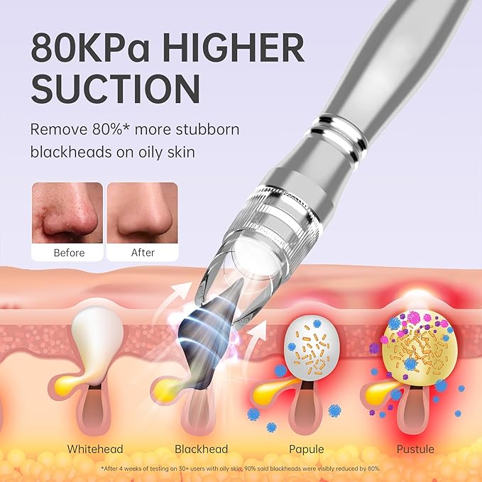 Blackhead Vacuum Removers, 2 in 1 Pro-Grade at-Home Spa Facial Vacuum Pore Cleaner for Blackheads, Whiteheads, Exfoliation, 20-80 Kpa Adjustable Suction for All Skin Types, White
