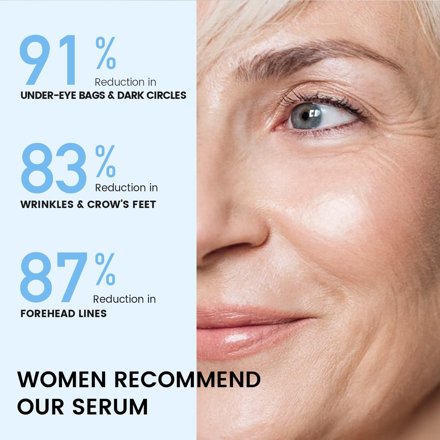 RONKIE Instant Eye Lift Cream: Reduces Eye Bags Wrinkles Puffy Eyes Dark Circles Crow’s Feet in Minutes for Mature Skin of Middle-aged Women 1 Fl Oz