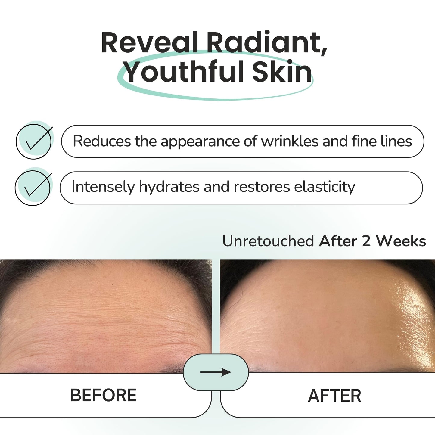 Advanced Forehead Wrinkle Patches Overnight - Anti Wrinkle Patches with Collagen, Peptides, Vitamin E - Strong Adhesion with Full Coverage for Forehead Wrinkles & 11 Lines, Made in Korea, 10 Count