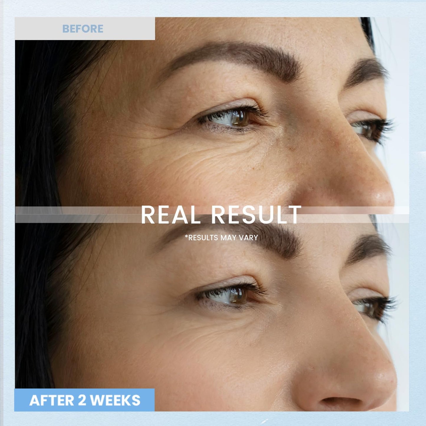 Retinol Eye Cream for Dark Circles: Anti-Wrinkle Under Eye Cream - Night Care Eye Cream Reduces Eye Bags