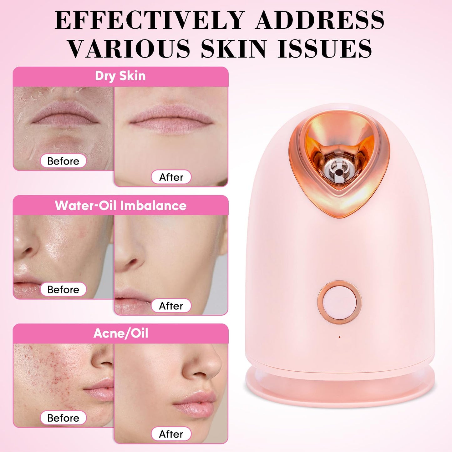 Pjordo Face Steamer for Facial Deep Cleaning Unclogs Pores, Nano Ionic Warm Mist Humidifier Steamer for Face Home Sauna SPA, Bonus 4 Piece Stainless Steel Skin Kit, Gift for Women