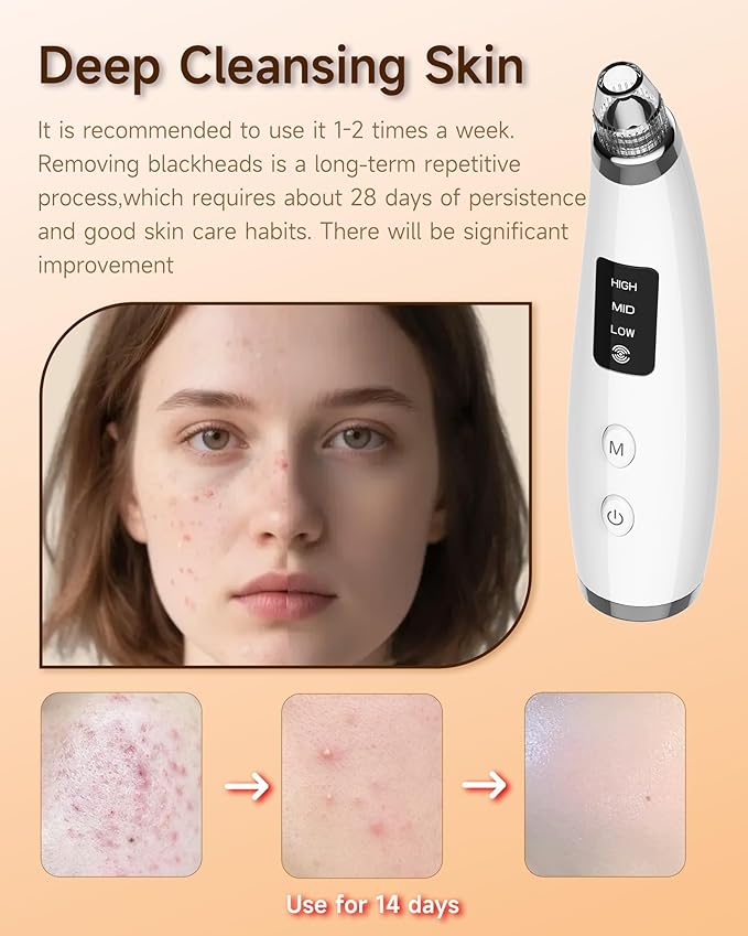 Blackhead Remover Vacuum, Type-C Rechargeable Pore Cleaner with 3 Adjustable Suction, 6 Probes & Comedone Extractor Tool Kit for Women and Men
