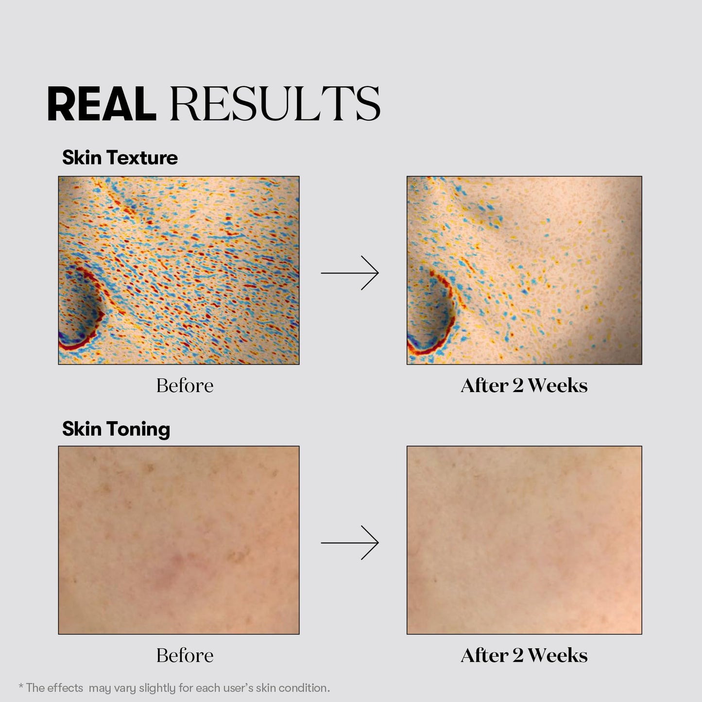 VT COSMETICS TX Toning Daily Mask 30 Sheets, Tranexamic Acid, Niacinamide, Glutathione for Acne Scars, Dark Spots, Sun Spots, Hydrating & Glowing Facial Mask, Fragrance-Free, Korean Face Mask