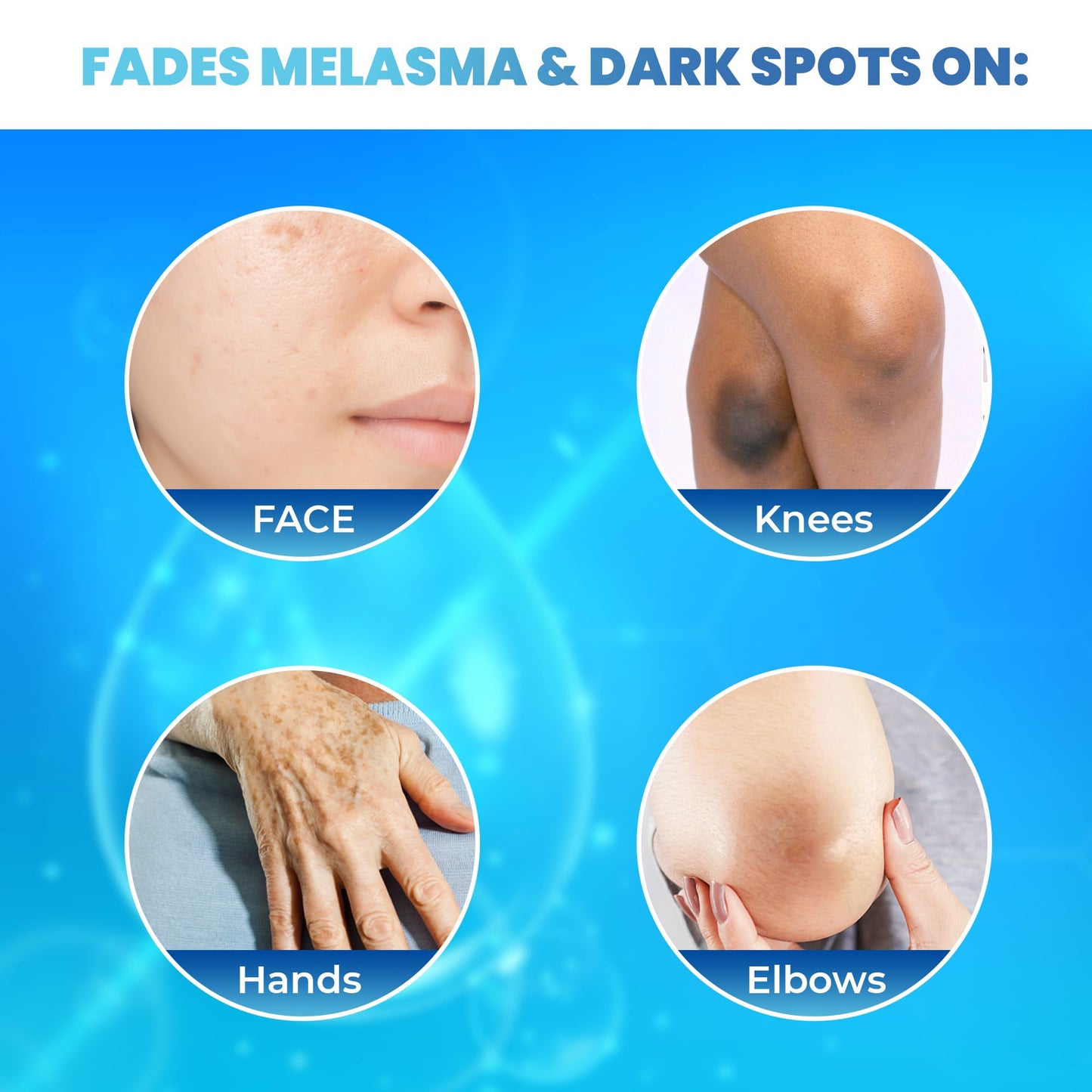 FAIR & WHITE Original Glutathione Dark Spot Serum - 1 fl oz / 30ml - Skin Brightening Serum, Helps to Reduce Skin Pigmentation - Skin Brightening Serum for Face & Body - with Glutathione & Vitamin C