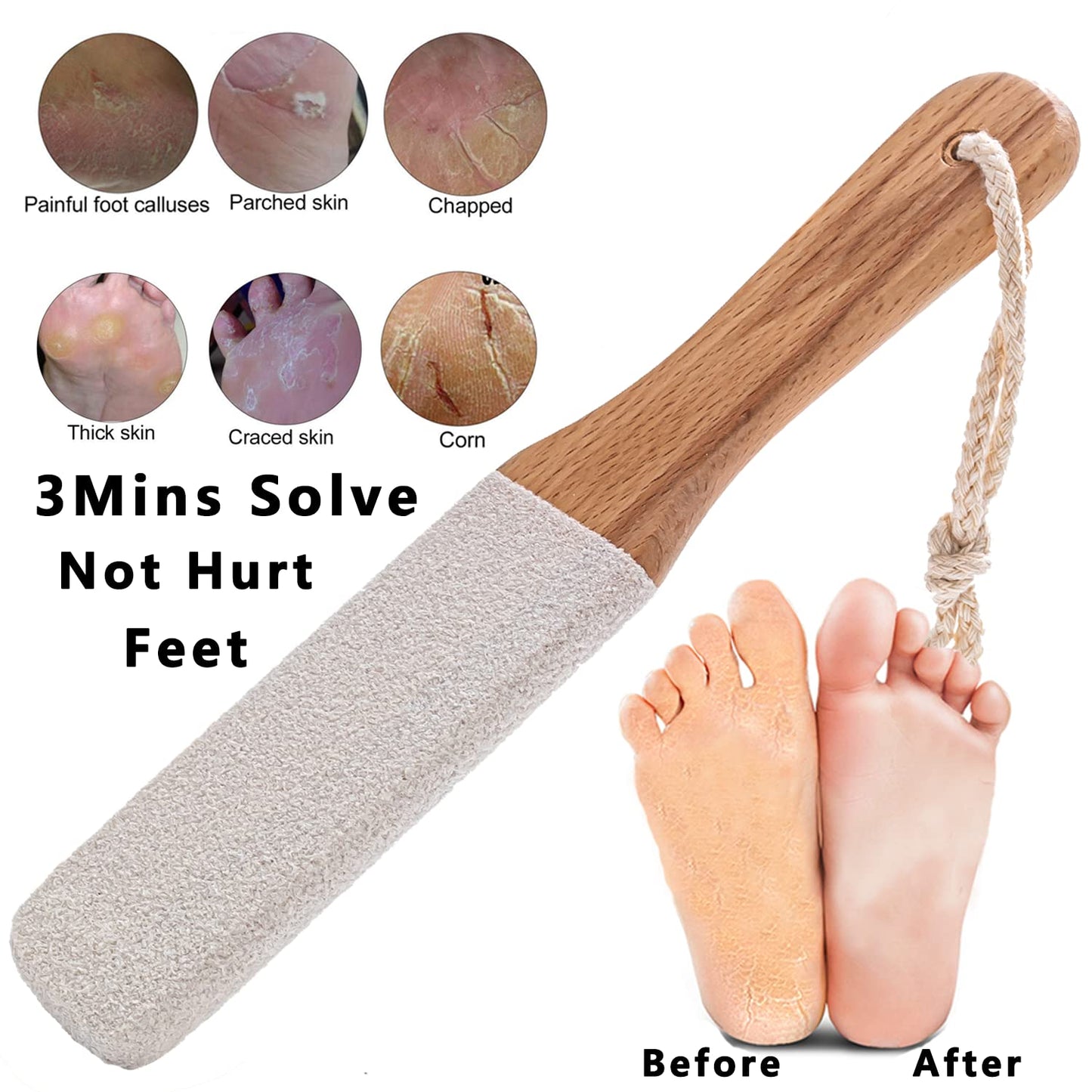 Kinepi Callus Remover Foot Scrubber Colossal Foot File Foot Care and Foot Exfoliator Foot Rasp Pedicure Tools Pumice Stone for Feet,Remove Corn Hard Skin Dead Skin for Use in Shower Foot Scraper Kit