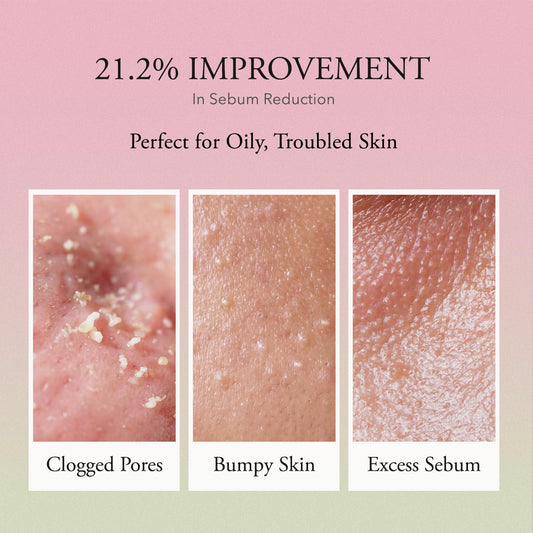 APRILSKIN Pink Aloe Vita Toner | Calms and Soothes Redness, Smoothens, and Controls Excess Sebum | 80% Pink Aloe Vera Water | Hydrating, Non-Sticky | Clean & Vegan Korean Skin Care (8.45 fl.oz)