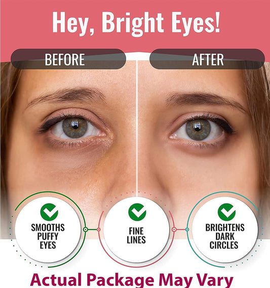 Eye Mask for Puffiness - Under Eye Patches for Dark Circles - Korean Under Eye Mask Patches for Puffy Eyes - Eye Gel Pads Depuffing Eye Brightener with Rose, Caffeine, Hydrogel & Collagen (10 Pairs)