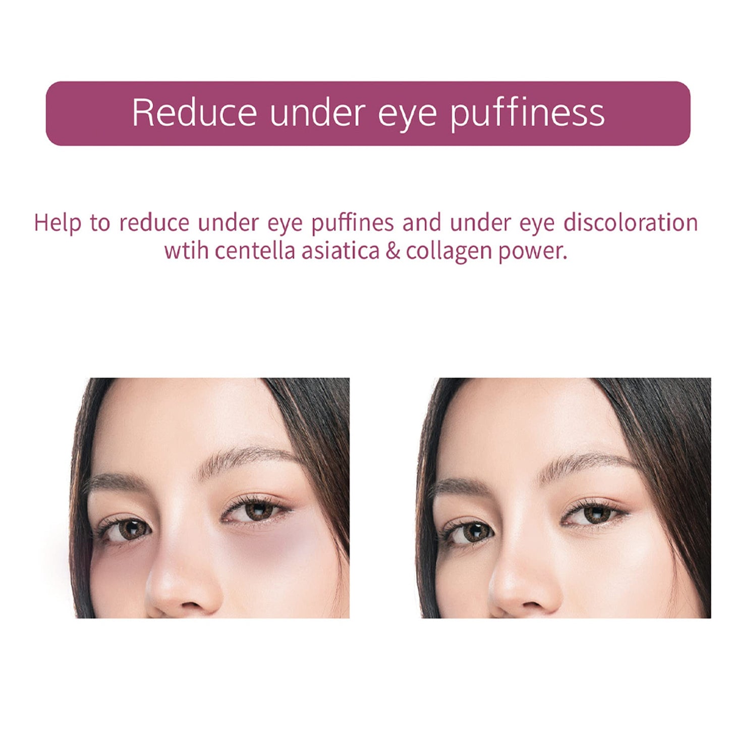 Veraclara Powerful Collagen Eye Patches - 5 Pairs - Puffy Eyes and Dark Circles Treatments | Reduce Wrinkles Undereye, Revitalize and Refresh Your Skin(1Pack)