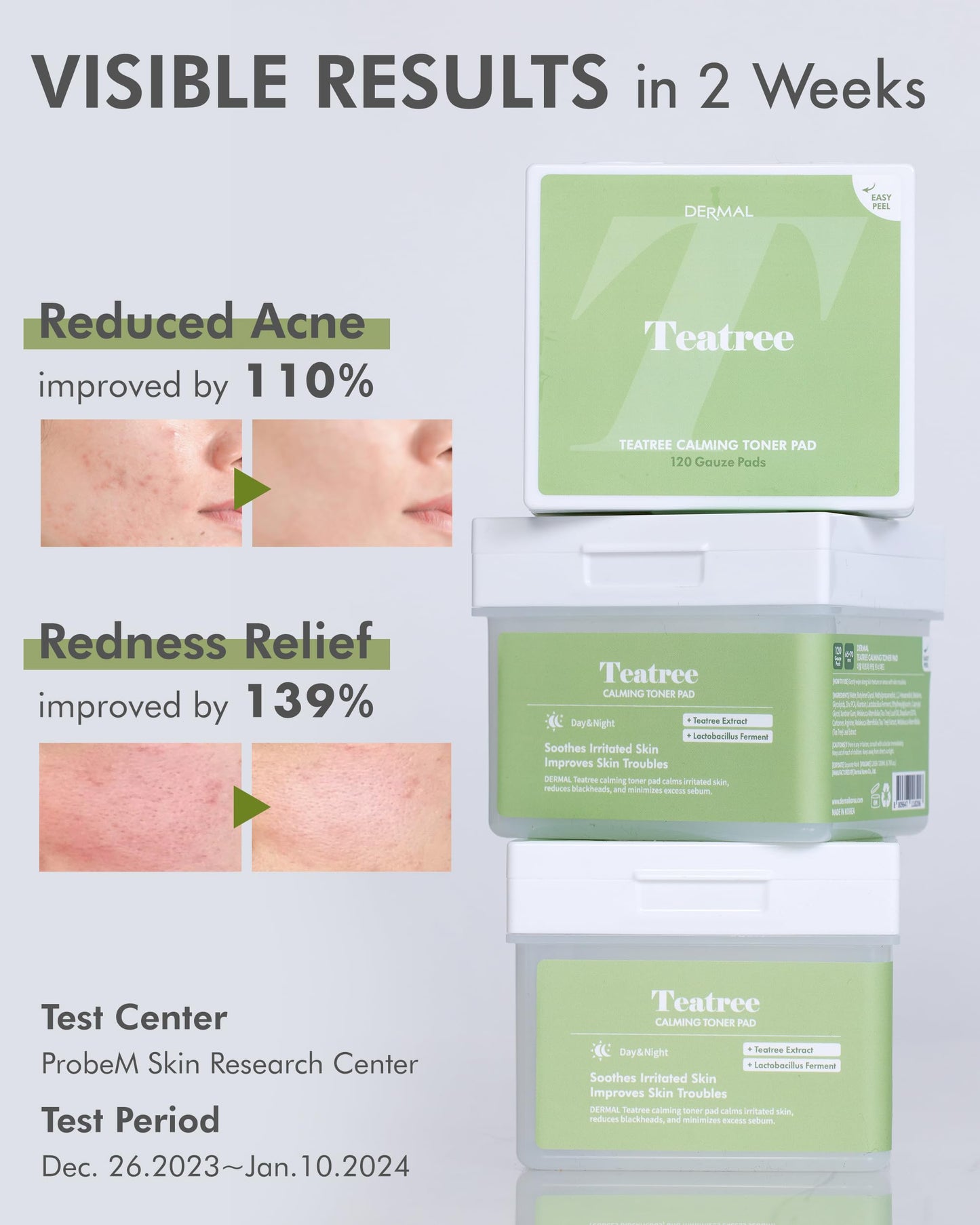 DERMAL Teatree Calming Toner Pad - Korean Toner Pad for Calming & Acne Improvement with Zinc PCA - Vegan Gauze Tencel Square Pads - Travel Kit 12 Pads, 3 Pack (Total 36 Pads)