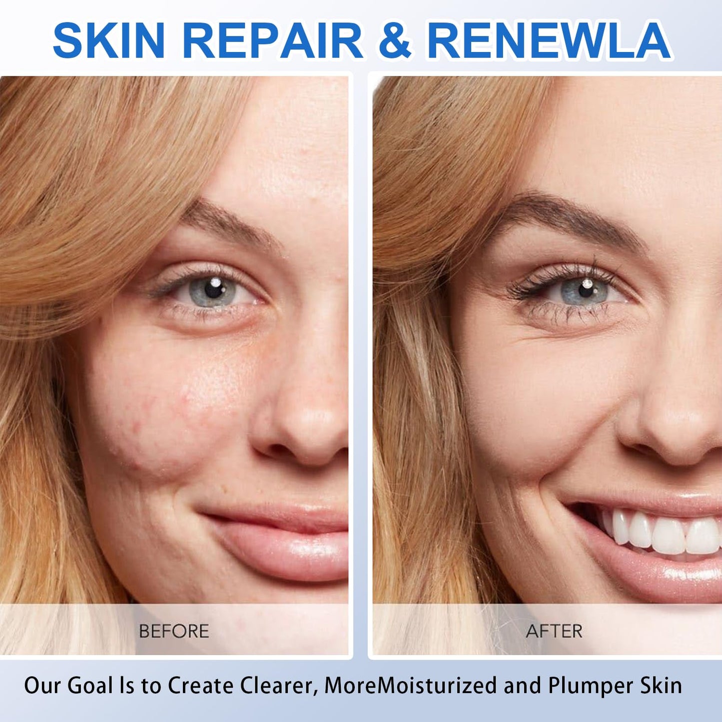 30 Pcs Hyaluronic Acid Serum Vials, Ultra Hydrating 5% Hyaluronic Acid serum Tubes, Hydrating Face Serum for Women Anti Aging, 1.5ml * 30pcs