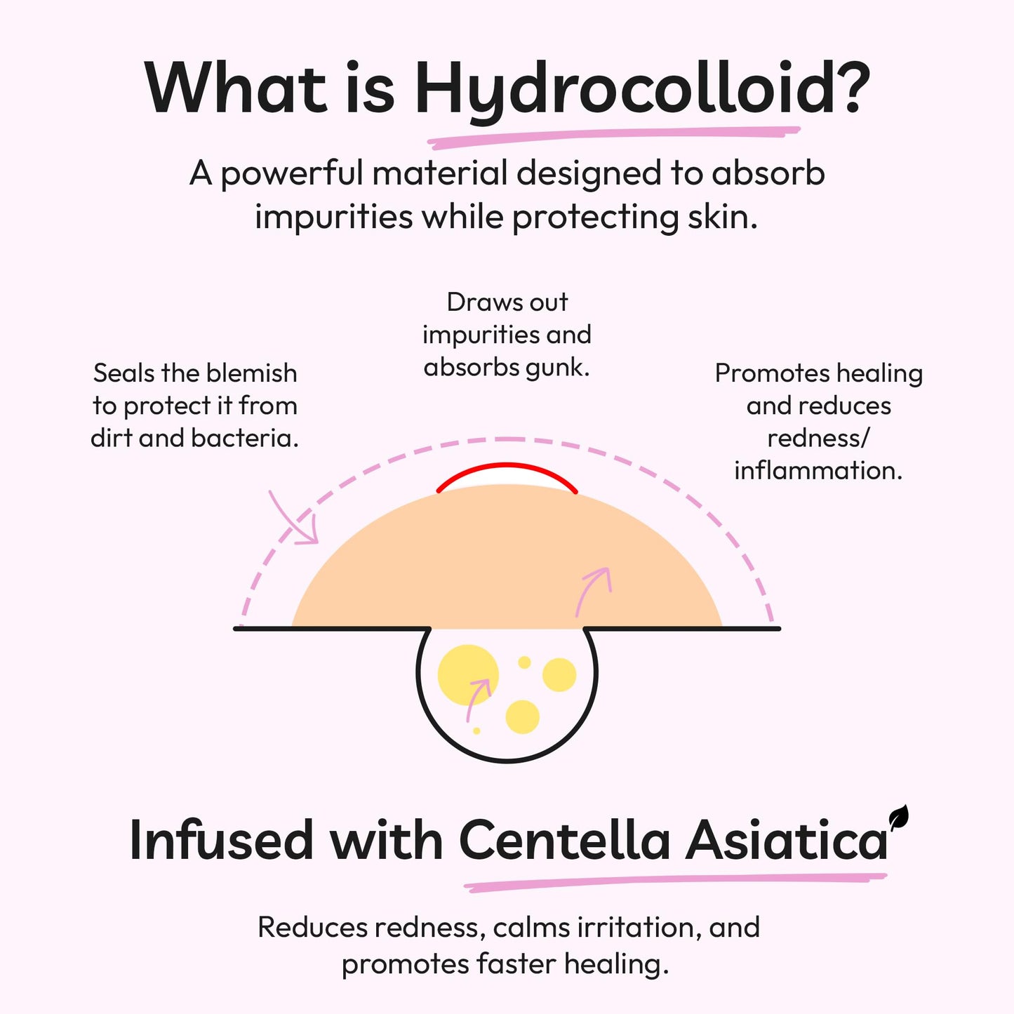 Clear Molecules Spot Stoppers Pimple Patches - Invisible Spot Patches for Acne Treatment, Hydrocolloid Patches for Spot Treatment, Vegan & Cruelty Free Korean Skincare (30 Count (Pack of 1))