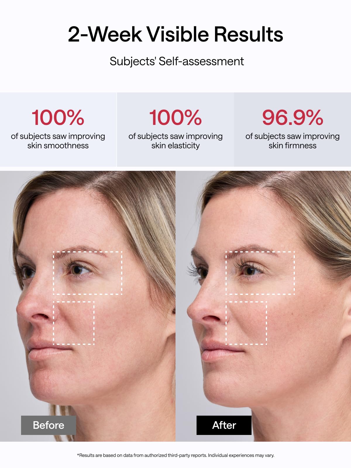 JMOON NouvelleSkin Facial Toning Device, FDA-Cleared Microcurrent Facial Device and Red Light Therapy for Face, 4 Modes & 5 Intensity Levels for Personalized Face Lift & Smoothing. M30U PR