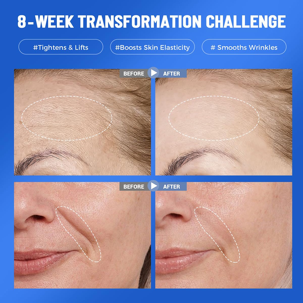 7 Pack Collagen Face Mask Deep Hydrating Overnight Facial Mask with Hyaluronic Acid Moisturizing Skincare Hydrogel Mask for Hydrating, Firming & Brightening