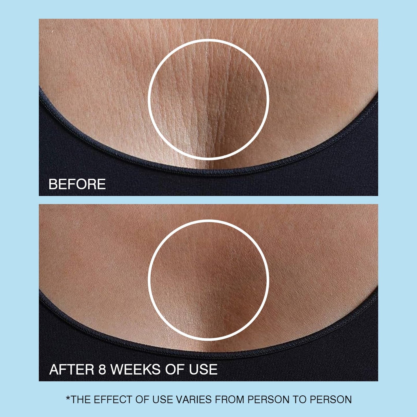 UJhay Retinol Neck Cream, Hyaluronic Acid and Caffeine Enriched Neck Firming Cream to Minimize Fine Lines & Dullness - 3-in-1 Moisturizing Cream for Neck, Chest and Face (50 ml/1.7 oz)