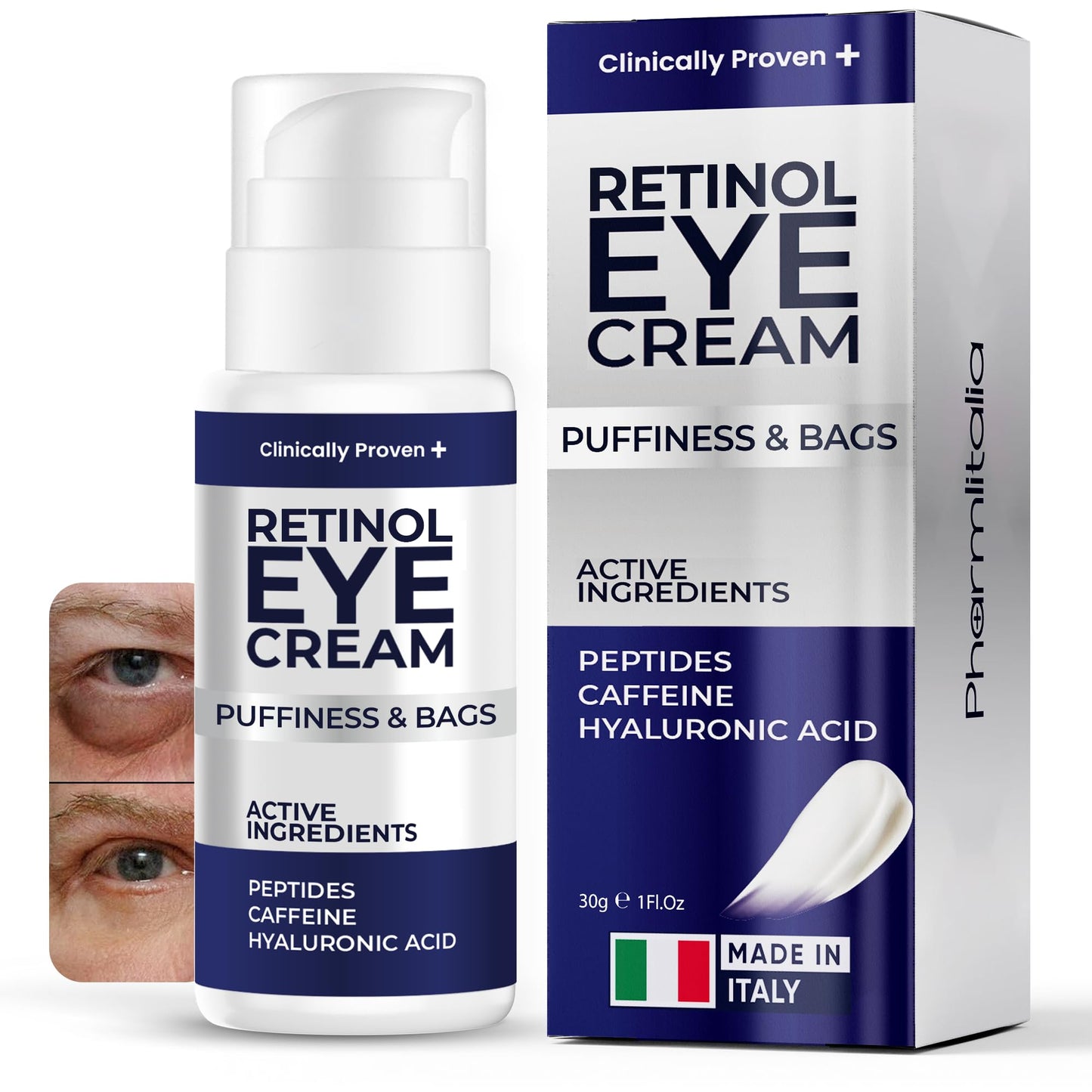 Under Eye Cream for Puffiness and Bags Under Eyes, Eye Bags Treatment for Men & Women - Anti Wrinkle Cream for Dark Circles, Baggy Eyes Treatment for Women with Retinol, Hyaluronic Acid & Caffeine