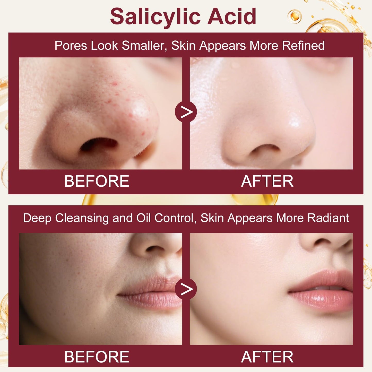 Skin Care for Teens 10-12,Women Skincare Set with Salicylic Acid,Professional Pore Minimizer Soothe, Hydrate, Oil Control, Deep Cleanse Women Facial Skin Care Products,Teen Girls Gifts Trendy Stuff