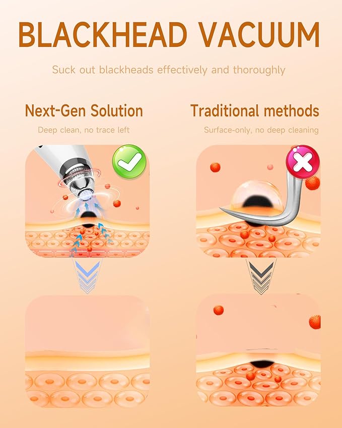 Blackhead Remover Vacuum, Type-C Rechargeable Pore Cleaner with 3 Adjustable Suction, 6 Probes & Comedone Extractor Tool Kit for Women and Men