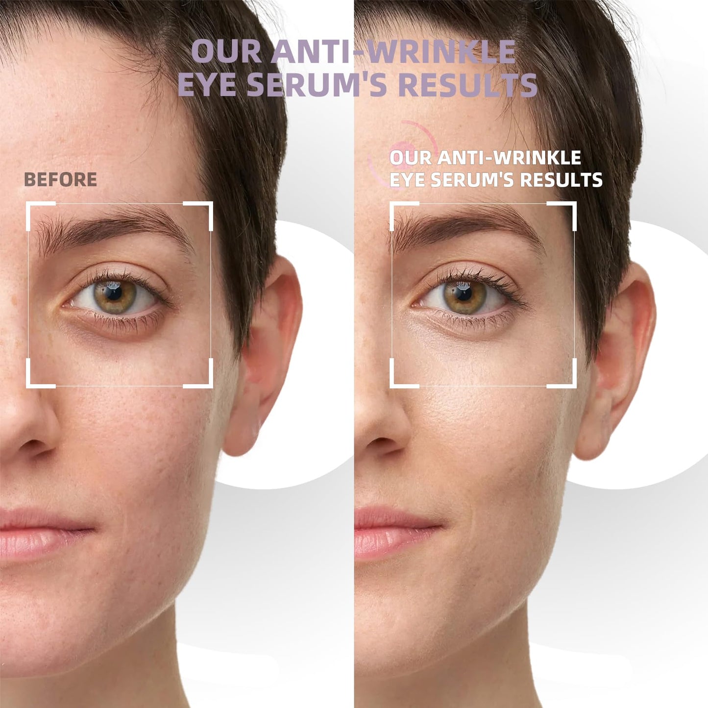 RWT 5% Caffeine Eye Serum & Under Eye Roller Cream for Dark Circles and Puffiness Eye Care Eye Roller Serum with 360° Massage Ball Eye Treatment Serum for Women