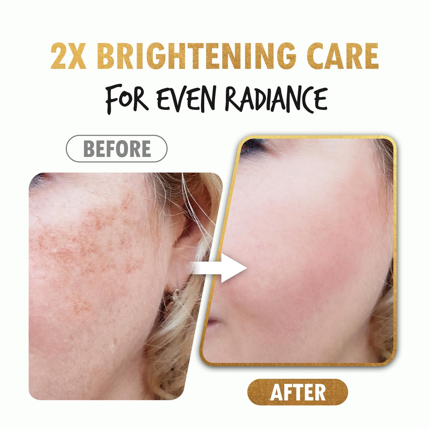 POUR LA PEAU Brightening Shot Serum | Skin Brightening Serum for Face | Organic Face Moisturizer Hyperpigmentation Serum | Hydrating Face Serum for Glowing Skin | Face Brightening Serum (1.01 Fl. Oz)