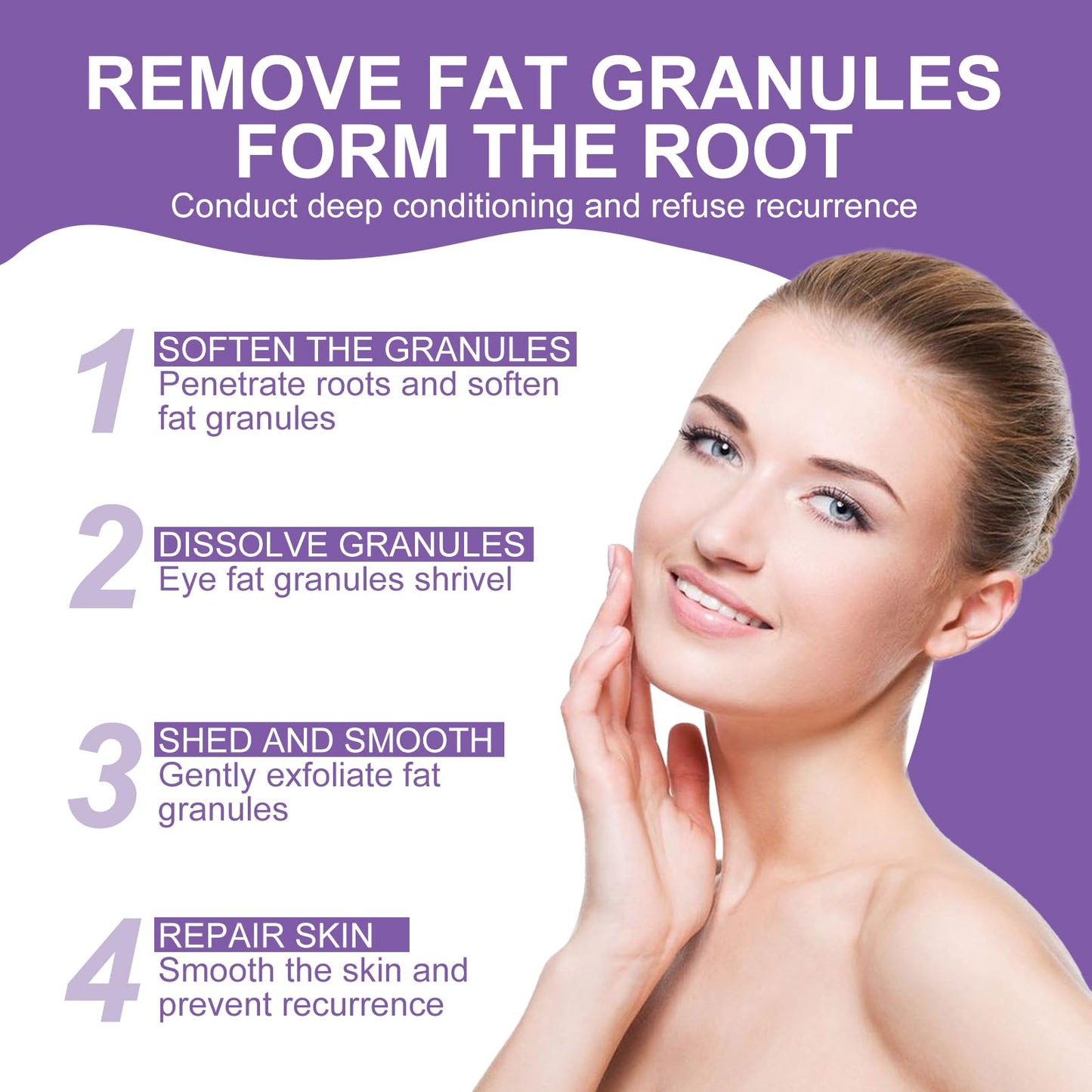 Milia Remover Cream for Eyes and Face,Milia Spot Remover with Salicylic Acid,Milia Acne Cream(1 Fl Oz (Pack of 1))