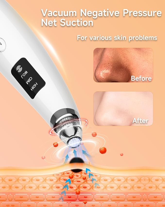Blackhead Remover Vacuum, Type-C Rechargeable Pore Cleaner with 3 Adjustable Suction, 6 Probes & Comedone Extractor Tool Kit for Women and Men