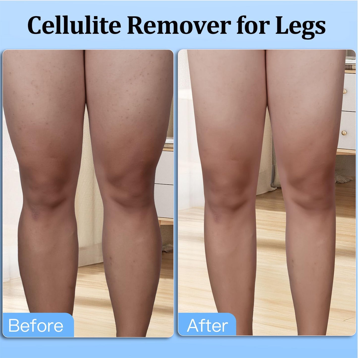 Cellulite Massage Roller, Cellulite Remover Tool for Thighs, Waist, Legs, Calf, Lymphatic Drainage, Fascia Massage, Anti-Celulitis, Body Sculpting, Relax Muscle Pain Relief Tool