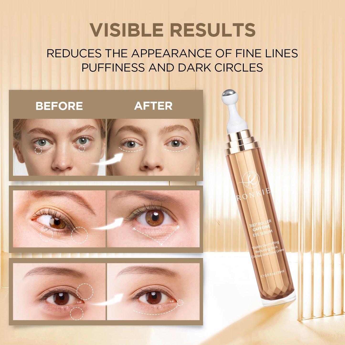 RONKIE Eye Cream for Dark Circles: Under Eye Cream with Caffeine Retinol - Reduces Under Eye Bags and Fine Lines Gold