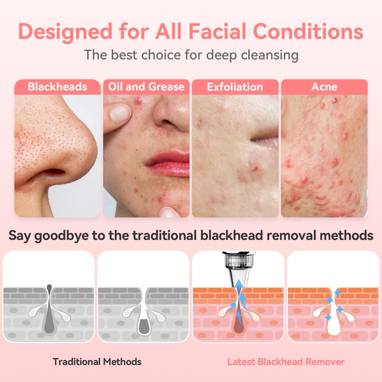 Blackhead Remover Pore Vacuum Upgraded Facial Pore Cleaner Electric Comedone Whitehead Extractor Tool-5 Suction Power,5 Probes,USB Rechargeable Blackhead Vacuum Kit for Women & Men