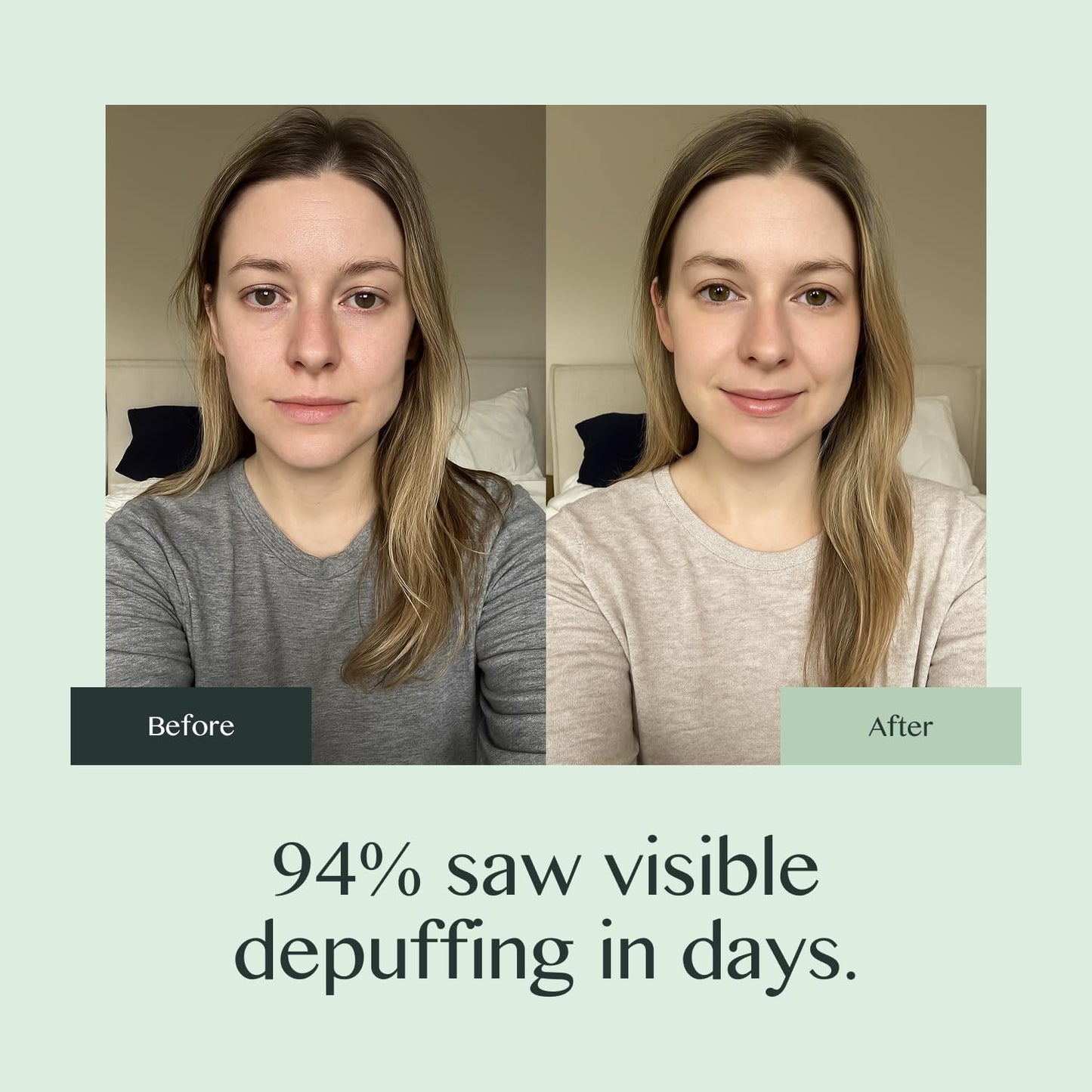 OURAGLOW Caffeine Eye Cream for Dark Circles and Puffiness – Moonstone Under Eye Cream with Cooling Tip, Retinol, Hyaluronic Acid & Peptides – for Wrinkles, Bags, Fine Lines – Fragrance-Free