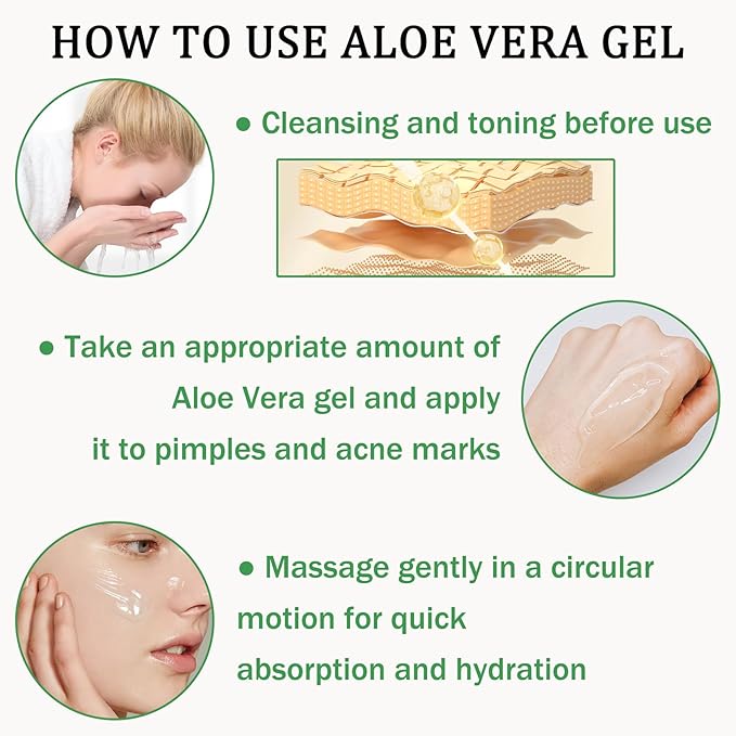 Aloe Vera Gel for Sunburn Relief,Hydrating Travel Size Aloe Vera Gel for Face,Moisturizing Sunburn Relief After Sun Lotion,Fast Absorbing,Non-Sticky Cooling After Sun Lotion Face Moisturizer (B)