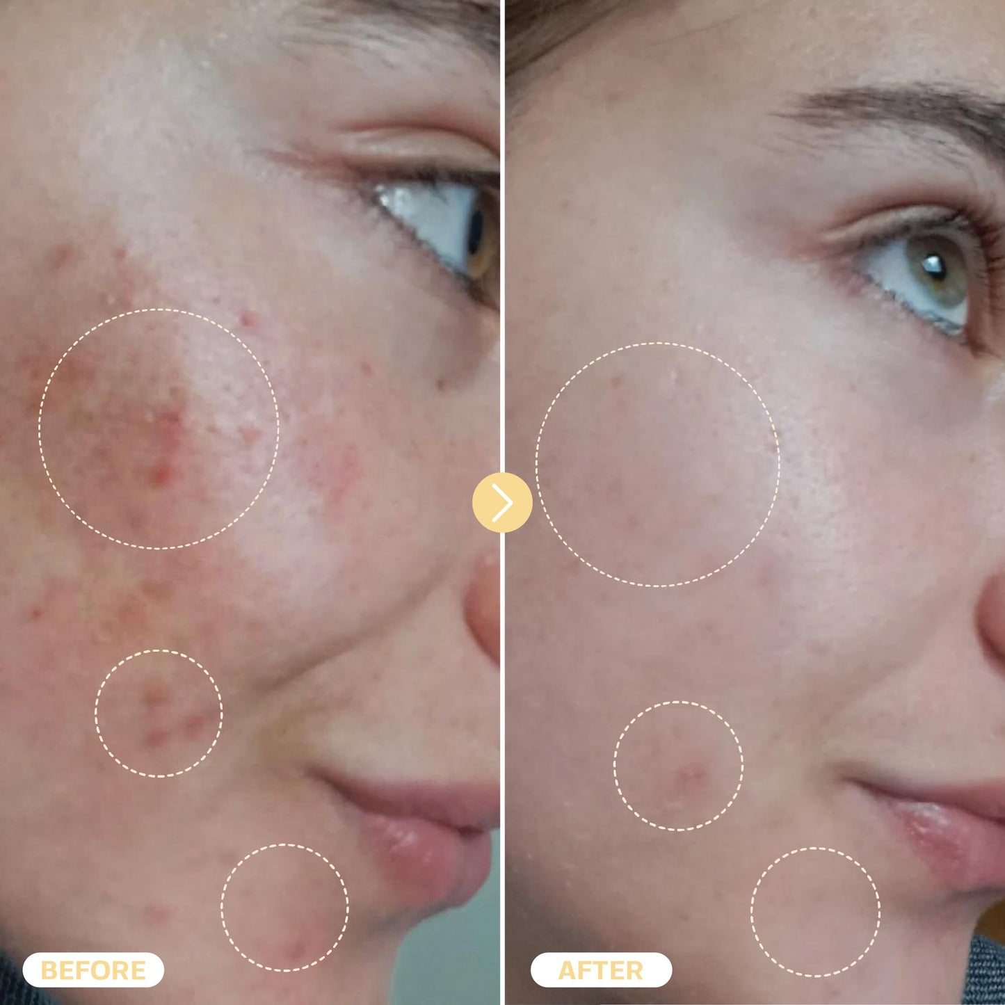 BASE LABORATORIES Hypochlorous Acid Spray for Face & Skin - Travel Size - Facial Toner Spray & Cleaner - Skin Repair Solution helps reduce redness, Irritations, acne - HOCL Molecule Spray 2oz